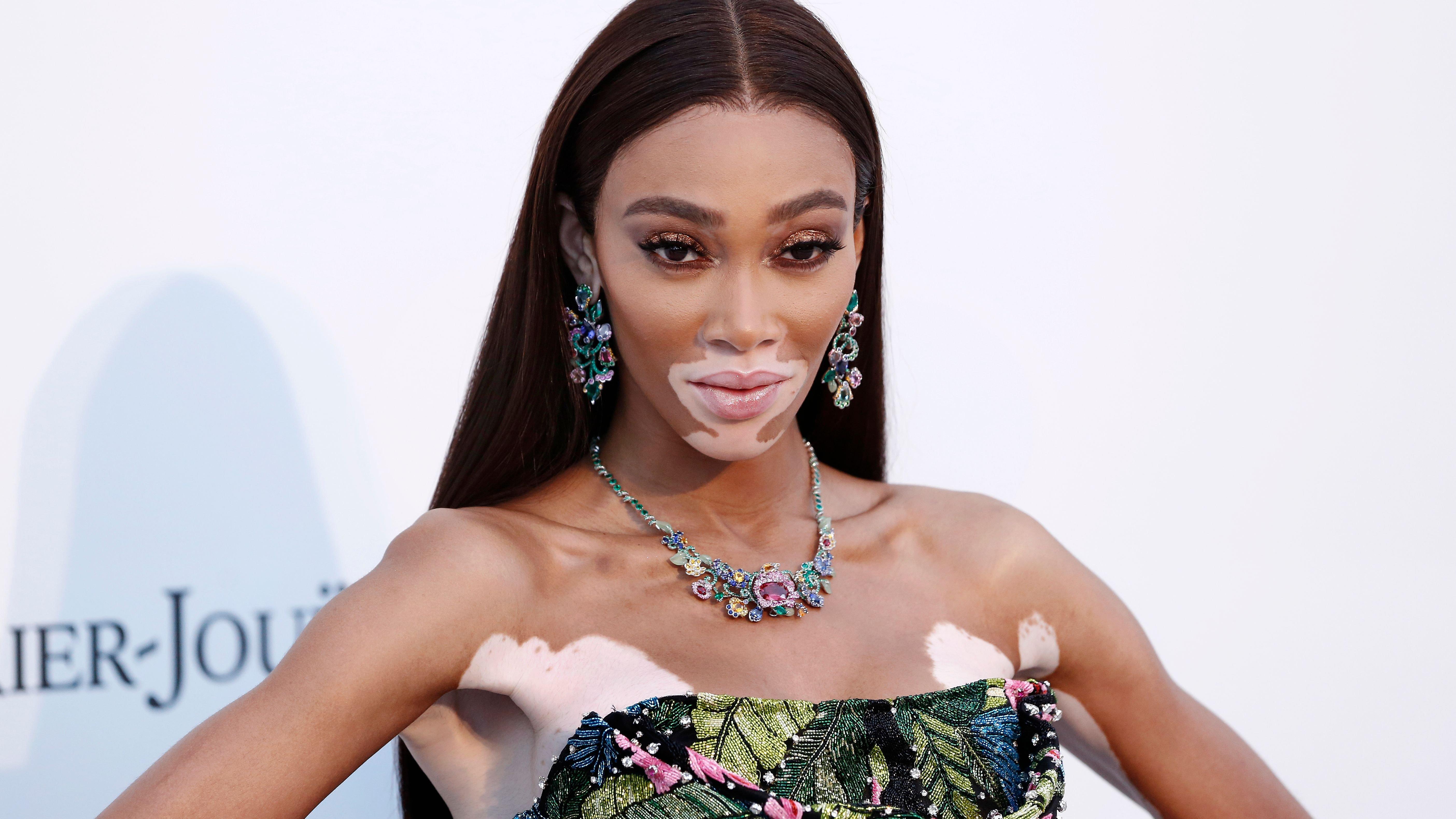 Winnie Harlow in statement necklace and floral-print dress